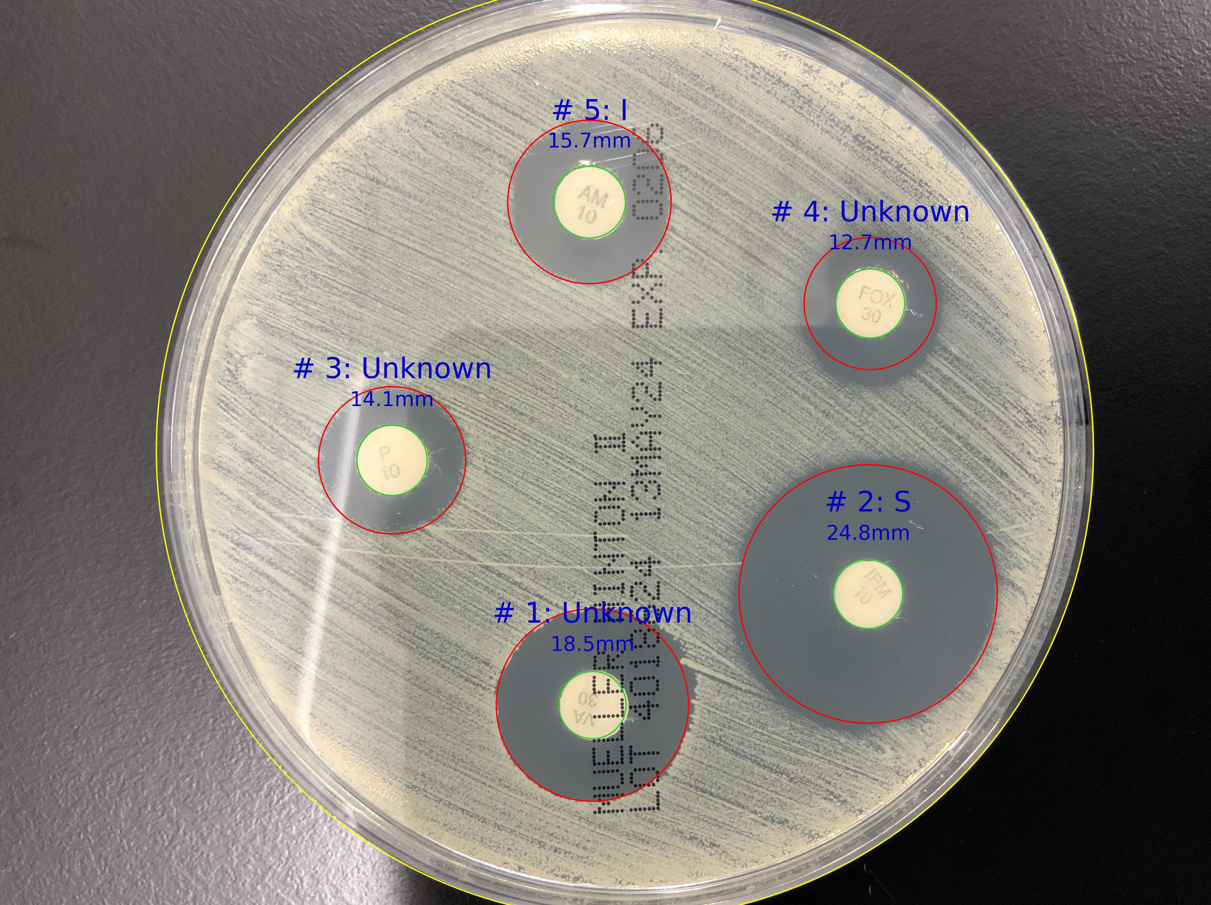 ZOI Pro - Zone of Inhibition - measurement logo